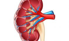 Each kidney at birth is composed of approx one million functional units called nephrons, these b ...