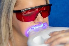 Professional Teeth Whitening Near Me | Teeth Whitening Houston