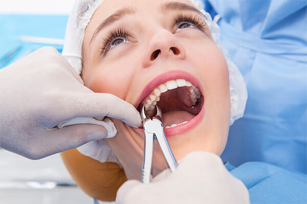 Wisdom Tooth Extraction Near Me | Wisdom Teeth Removal Near Me Houston, TX