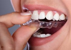 Advantages Of Adult Orthodontics Near Me | Ivanov Orthodontic