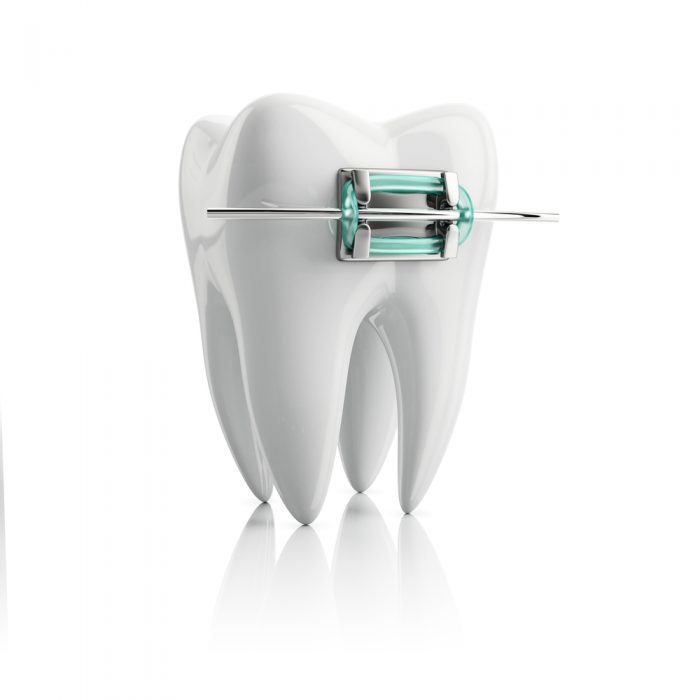 The Process Behind Choosing Braces Band Colors?