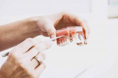 Best Dental Implants in Houston, TX