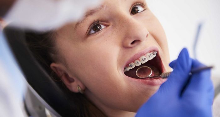 Emergency Root Canal Specialist Near Me