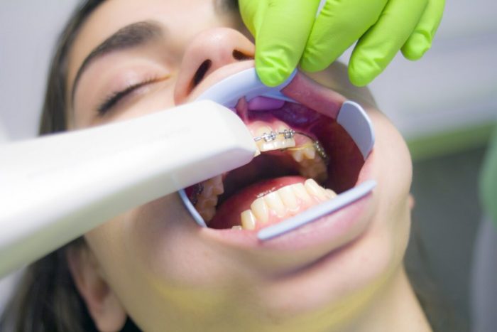 Orthodontist Specialists in North Miami
