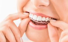 Teeth Grinding Treatment in Houston Tx