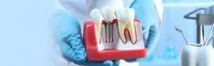 What To Expect During A Single-Tooth Dental Implant?