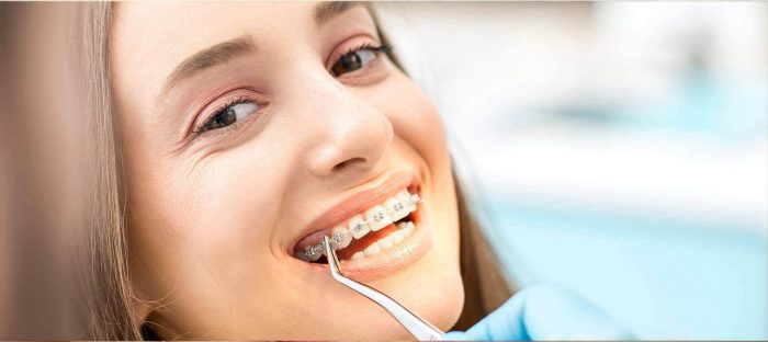 Best Braces Orthodontists Near Me