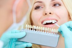 How To Choose The Best Dental Crown In Houston