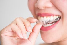 What Are The Advantages Of Invisalign?