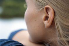 Ear Surgery Otoplasty Houston, Texas
