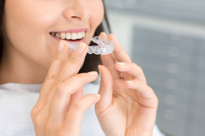 Invisalign Cost in Miami, FL | Invisalign Aligners Cost