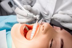 What Are The Benefits Of Teeth Cleaning?