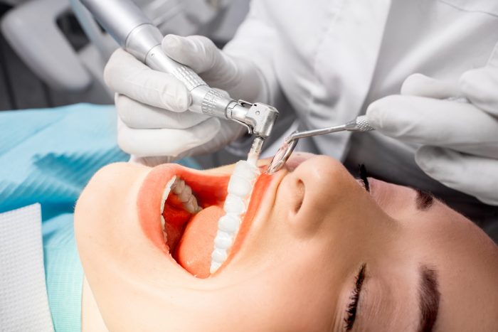 What Are The Benefits Of Teeth Cleaning?