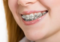 Best Orthodontist Specialists In Hialeah