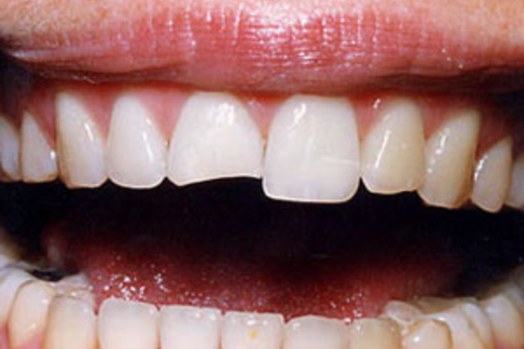 Cosmetic Dentistry Manhattan, NYC