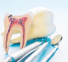 Root Canal Specialist Near Me