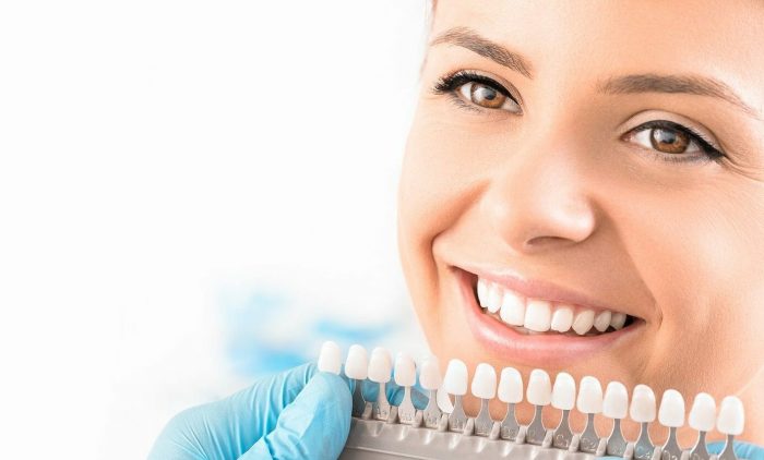 Cosmetic Teeth Whitening Manhattan, NYC