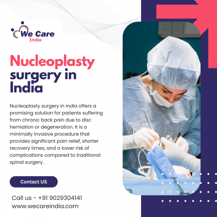 Nucleoplasty surgery in India